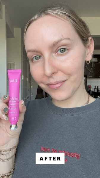 Kinonen after applying the Paula's Choice ProCollagen Peptide Firming Eye Gel